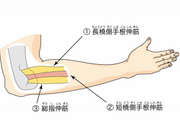 テニス肘の手術から回復するためのヒントとコツ